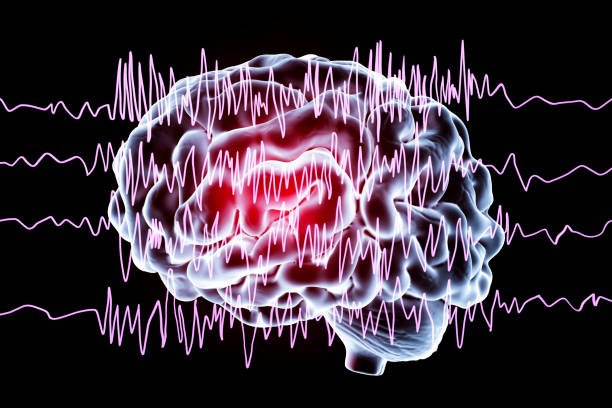Dr. Kapil Patil - Epilepsy and Seizures