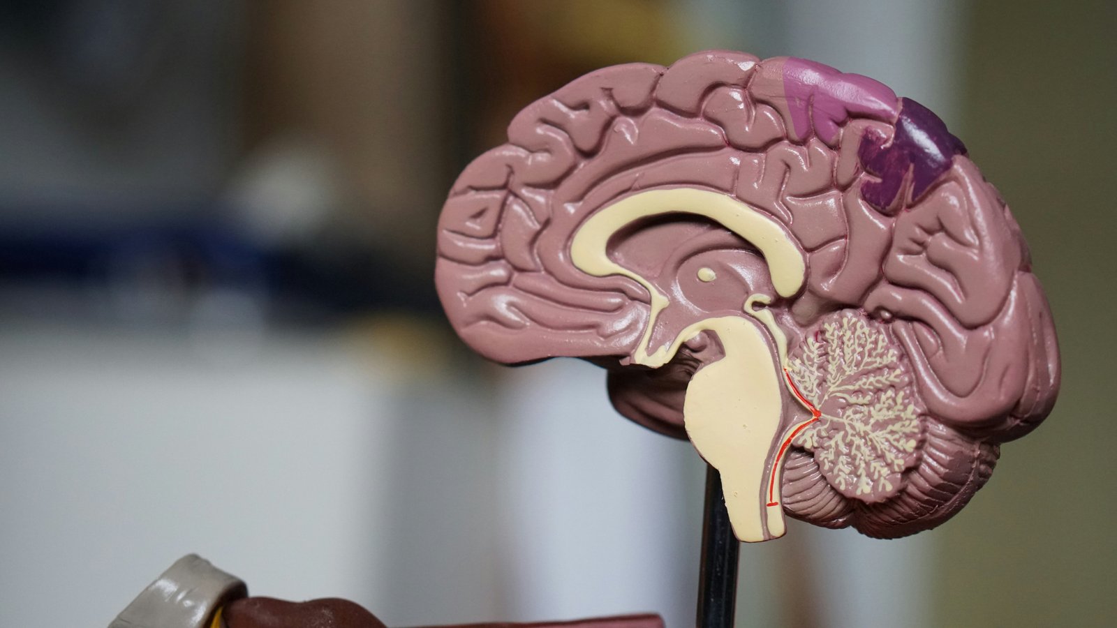 Neurology - brain-tumour