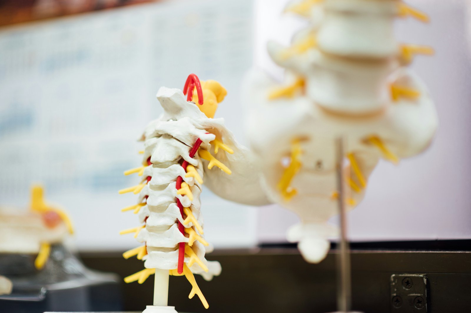 Neurology - spine-pain