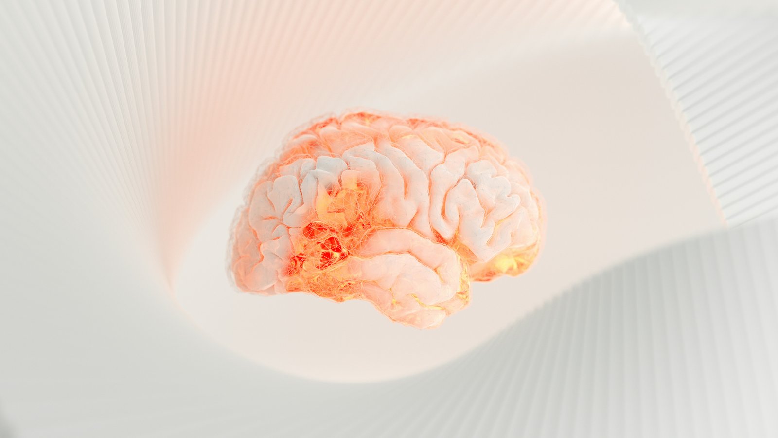 Neurology - stroke